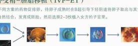 国内试管三代可以选择婴儿XY吗？2026年最新条件与技术解读